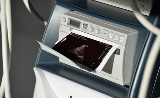 Ausdruck eines Ultraschallbildes während der Ultraschalluntersuchung